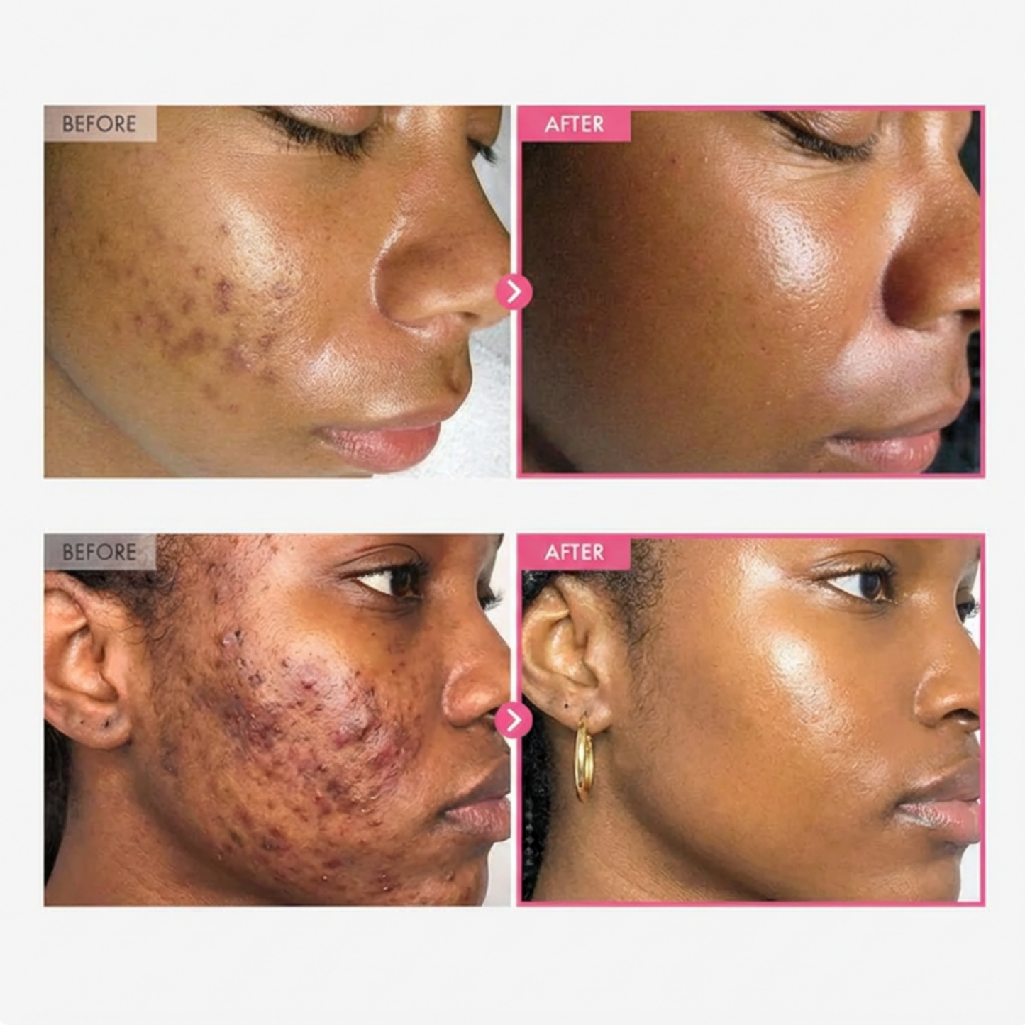 VH™ Korean Brightening Cream