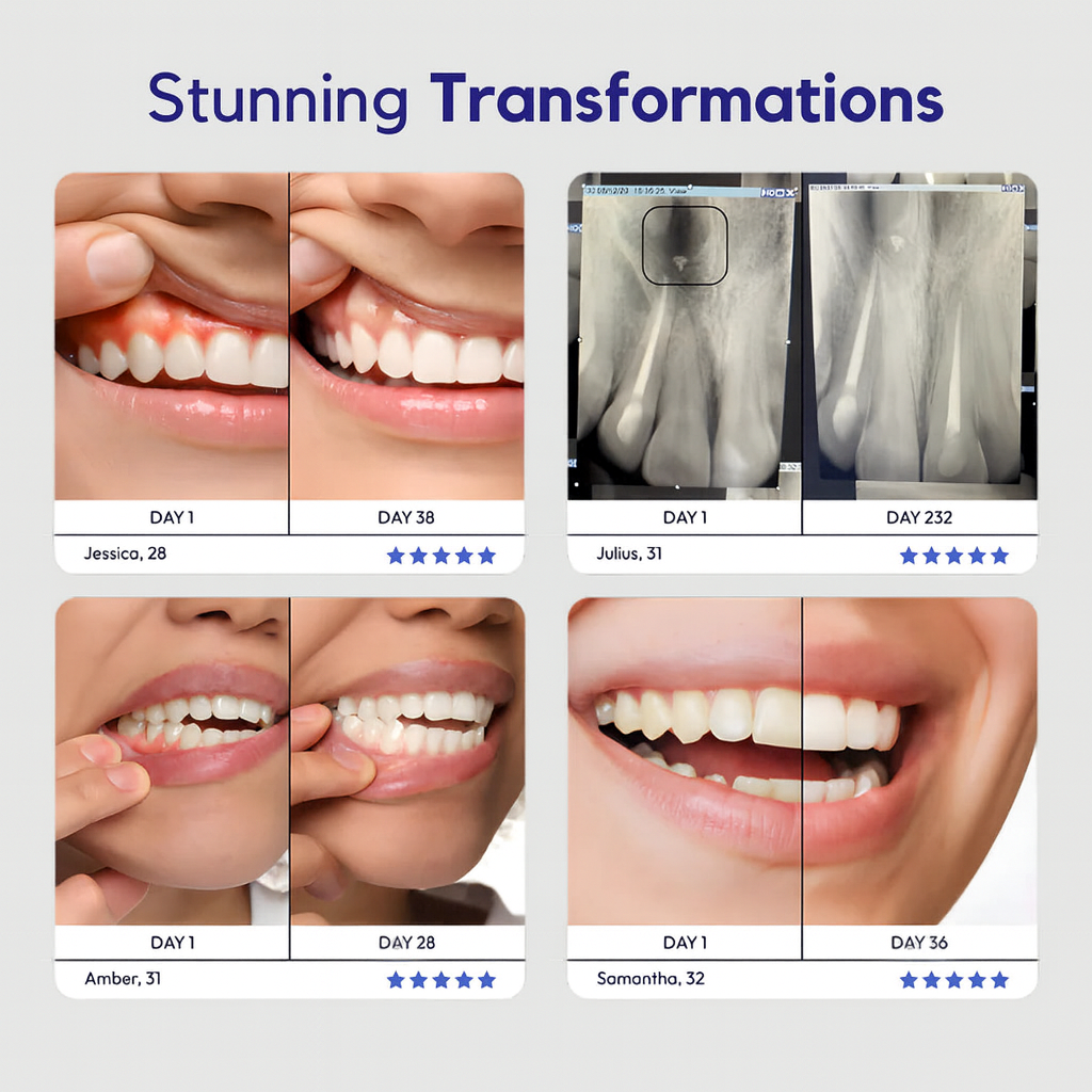 VH™ Hydroxyapatite Remineralizing Tooth Armor