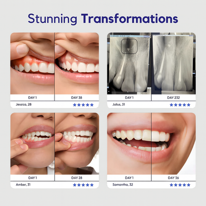 VH™ Hydroxyapatite Remineralizing Tooth Armor