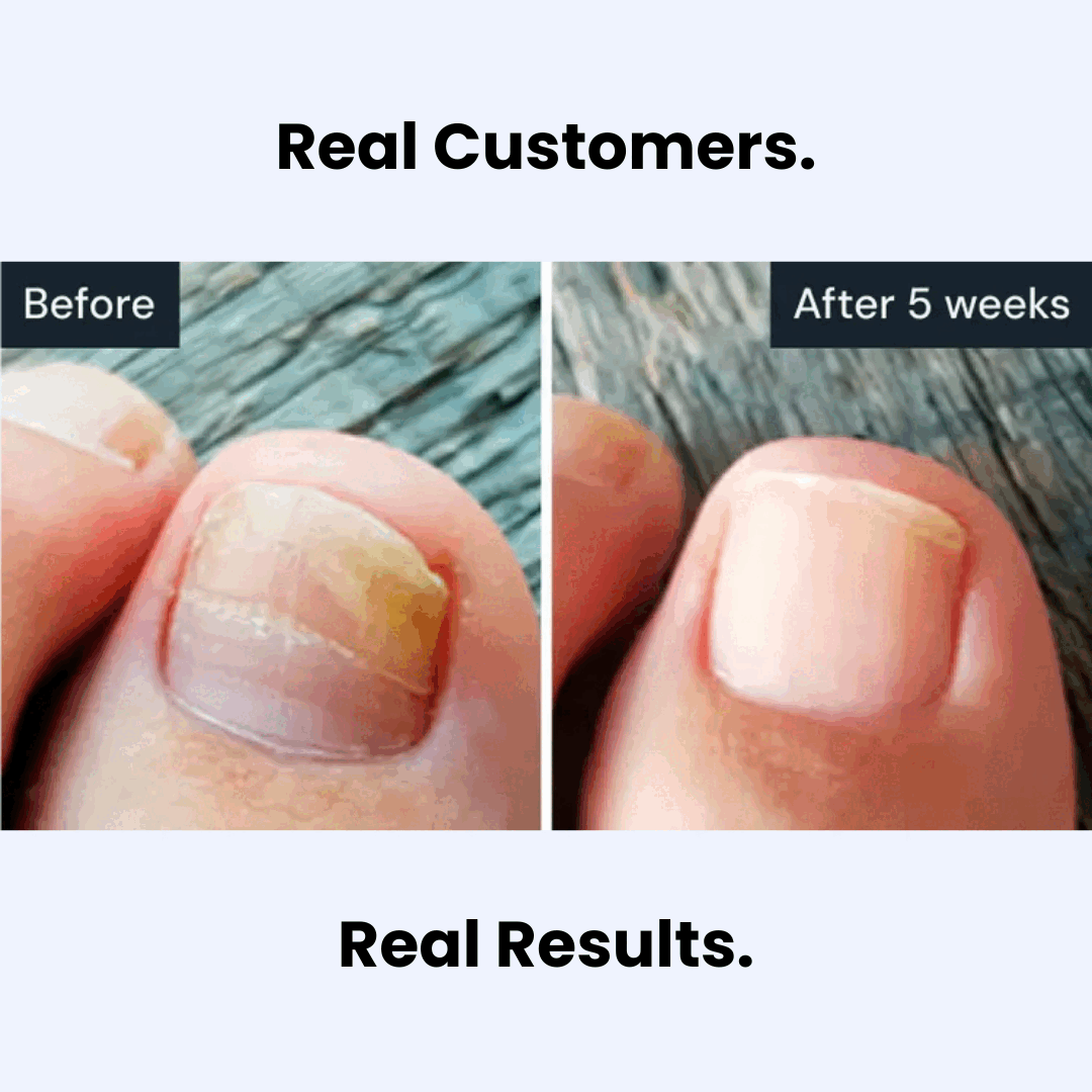 VH™ Antifungal Pen